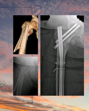 Slider image (10) Dr. Rodrigo Aguirre Rojas Orthopedic Surgeon in Mexico